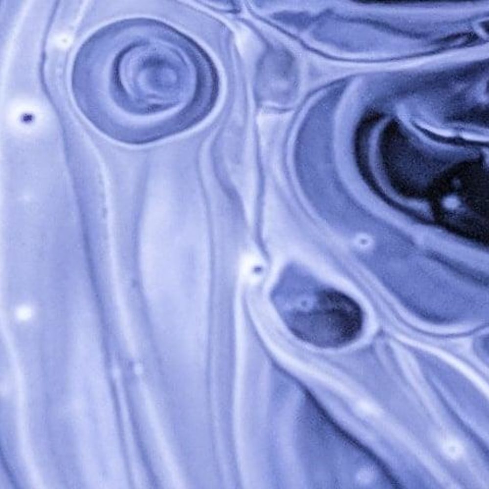 Image for ADVANZ PHARMA to acquire Intercept’s business in Europe, Canada, and all other markets outside of the U.S.